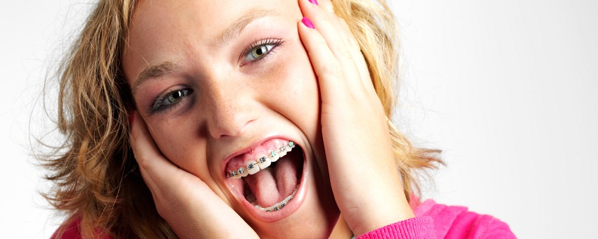 Tips untuk Mengurangi Rasa Sakit akibat Kawat Gigi – Part 2