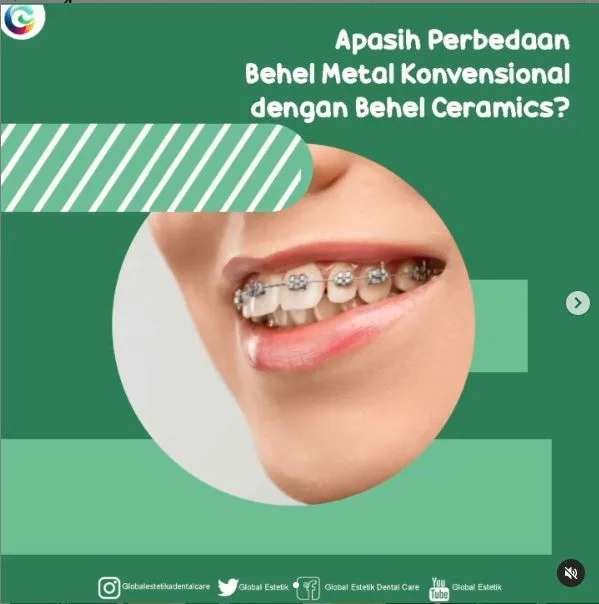 Behel Depok